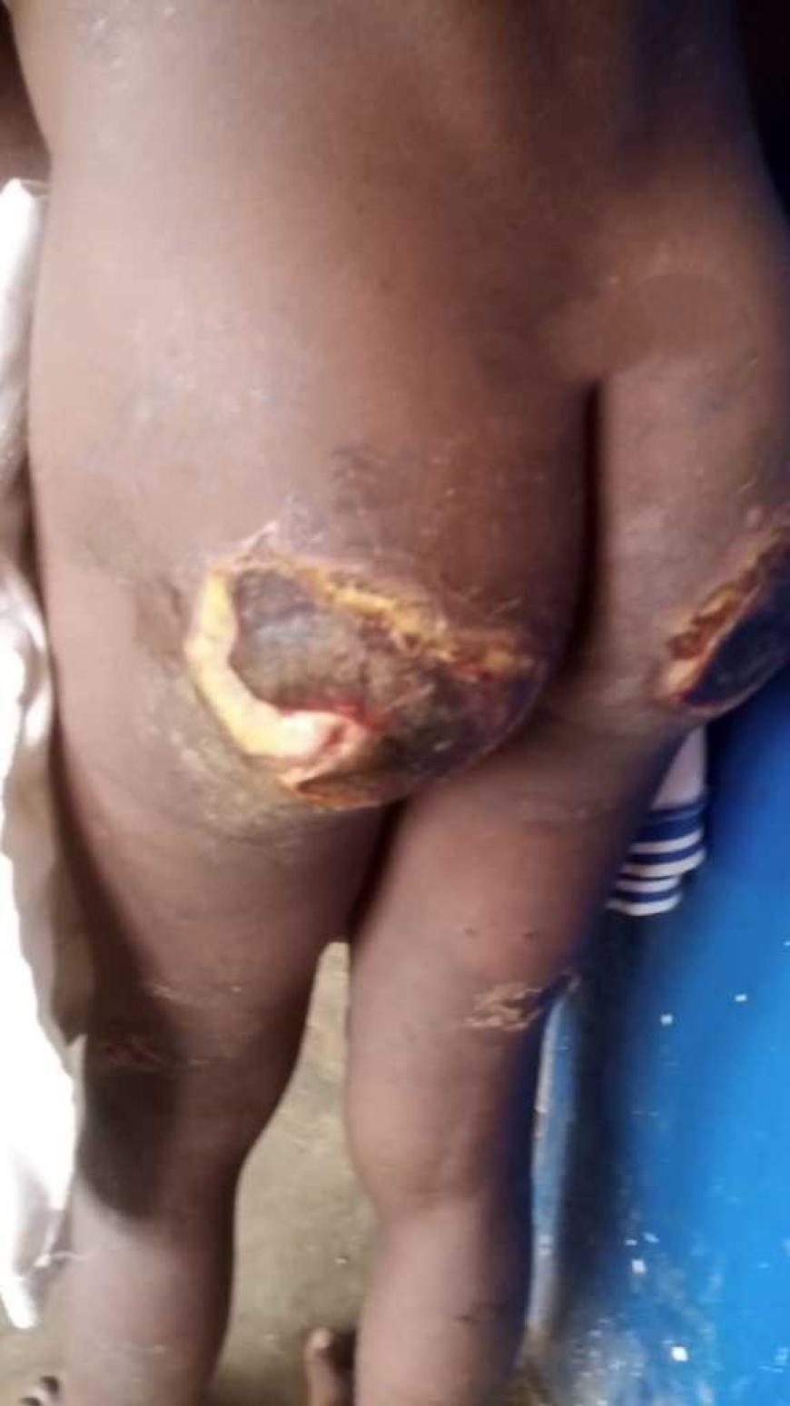 For Stealing LRD$50.00, Man Mercilessly Brutalized His 13 Year Old Son