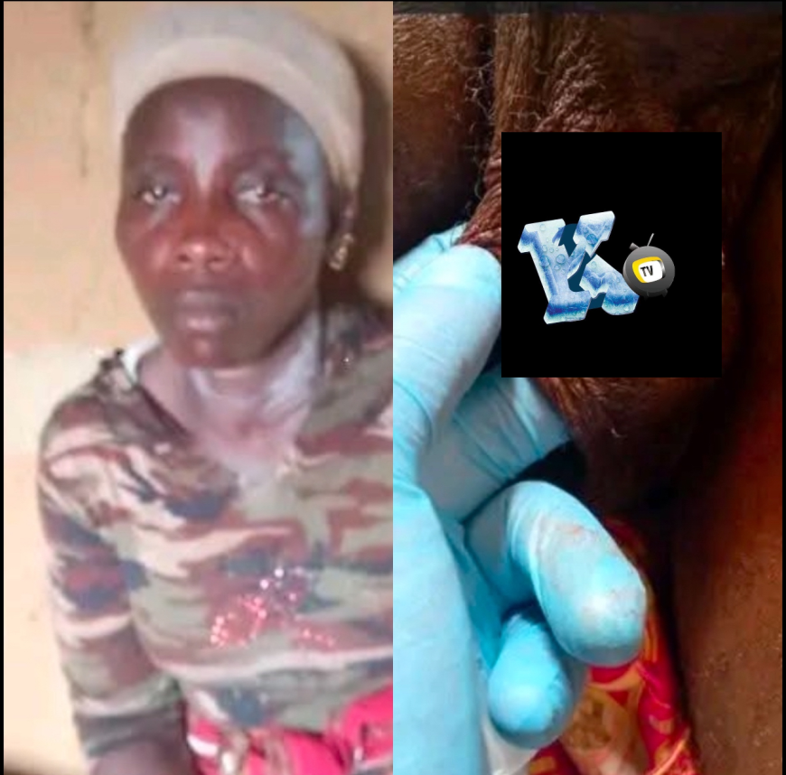 Woman cut her Husband’s private part During Midnight Hour for Cheating on her