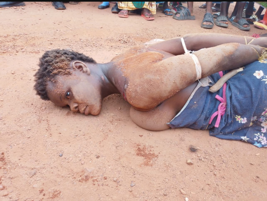 Girl, 19, Brutally Beaten by Neighbors in Foya City