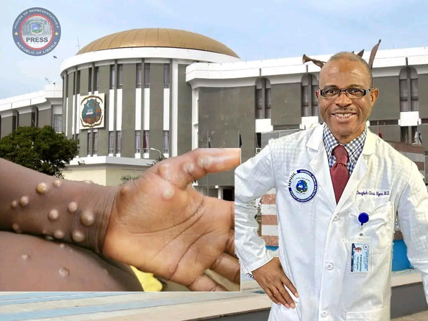 House of Representatives Set to Screen National Public Health Institute on Monkeypox Outbreak