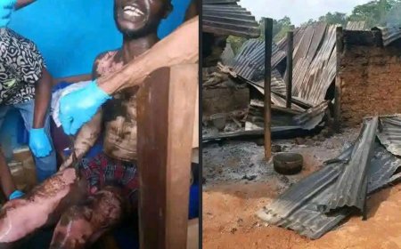 Gasoline Drum Explosion in Sinoe County Leaves Two Men Seriously Injured