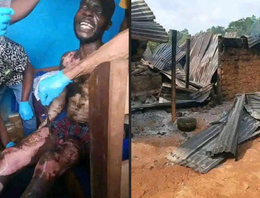 Gasoline Drum Explosion in Sinoe County Leaves Two Men Seriously Injured