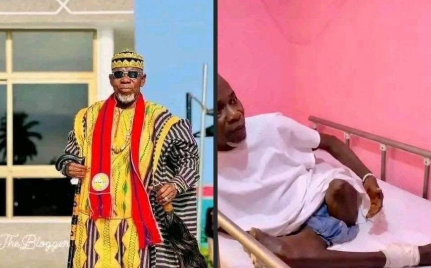 Former Traditional Council Chairman Zanzan Karwor Suffers Leg Amputation, Family Appeals for Support