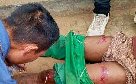 “Crushed by Iron, Trapped in Poverty: Workers Cry Out Over ‘Modern Slavery’ Conditions at China Union Mine”