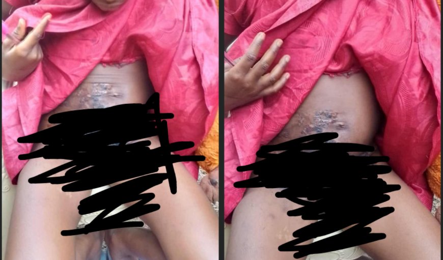 Stepmother Allegedly Pours Boiling Water on 11-Year-Old Girl